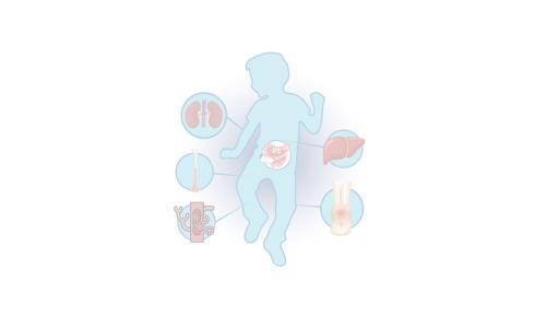 event list item image